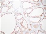 3184A | Control Slides:Immunopathology; CD56
